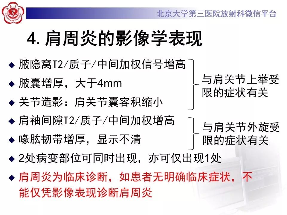 【PPT】肩周炎/粘连性关节囊炎影像表现