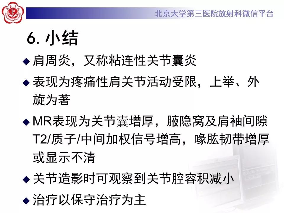【PPT】肩周炎/粘连性关节囊炎影像表现