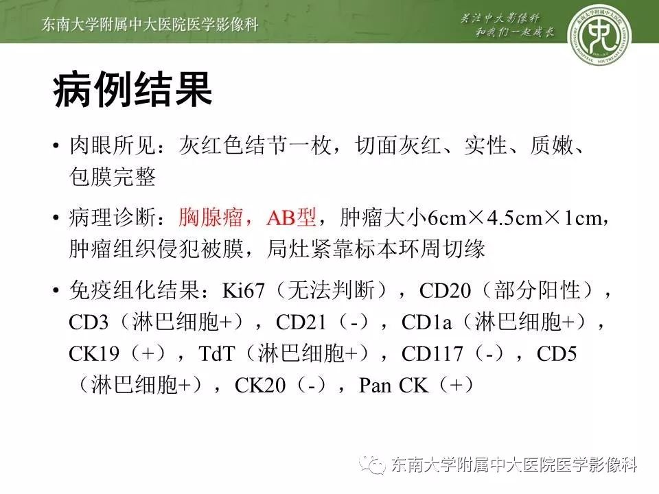 【PPT】胸腺瘤