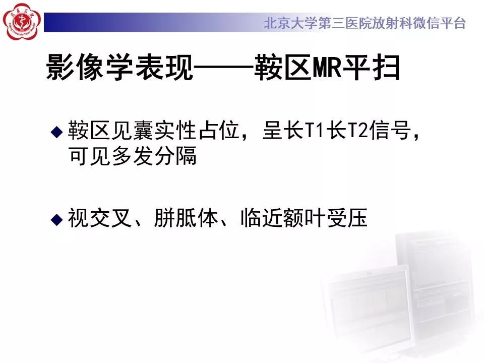 【PPT】颅咽管瘤影像