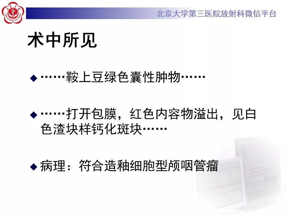 【PPT】颅咽管瘤影像