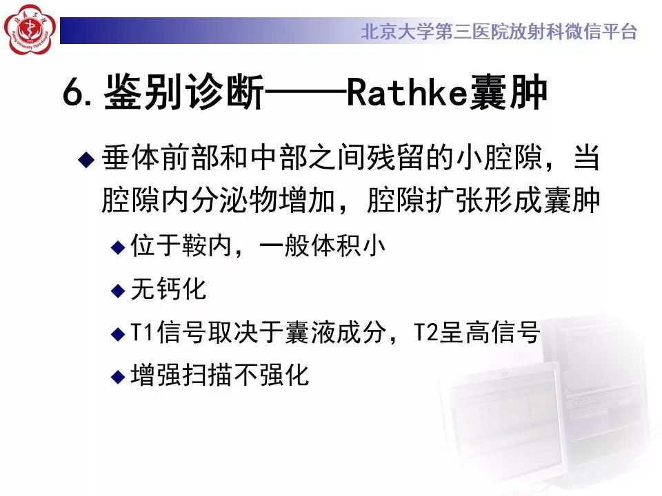 【PPT】颅咽管瘤影像