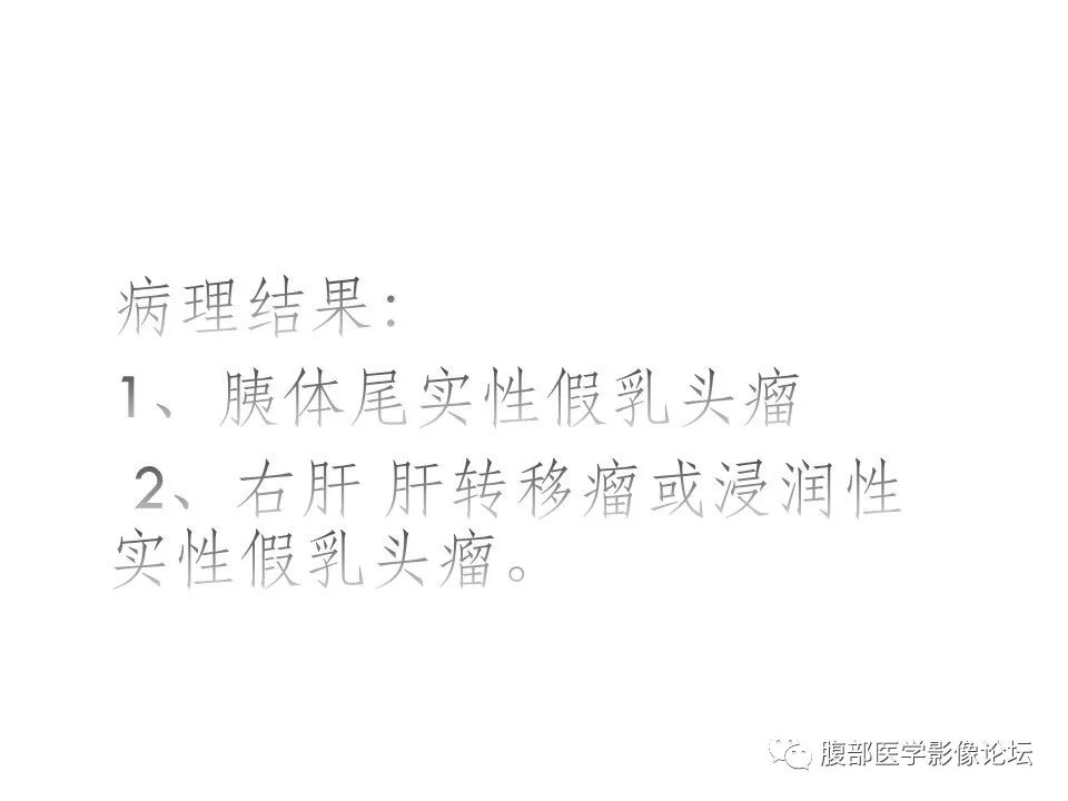 【病例】胰体尾实性假乳头瘤1例CT影像