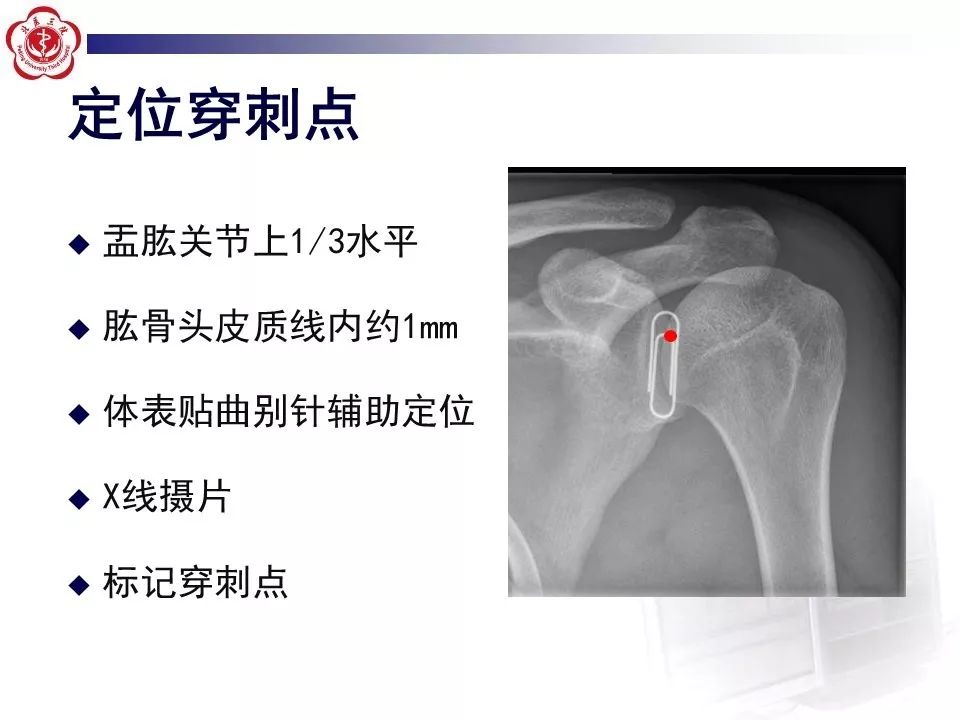 【PPT】肩关节MR造影方法