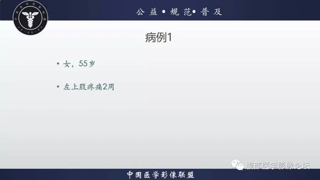 【病例】脾脏窦岸细胞血管瘤三例讨论及文献复习