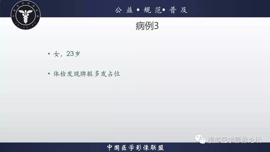 【病例】脾脏窦岸细胞血管瘤三例讨论及文献复习