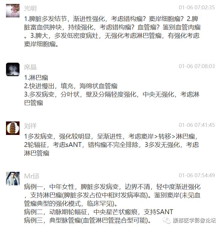 【病例】脾脏窦岸细胞血管瘤三例讨论及文献复习