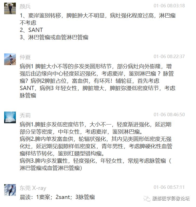 【病例】脾脏窦岸细胞血管瘤三例讨论及文献复习