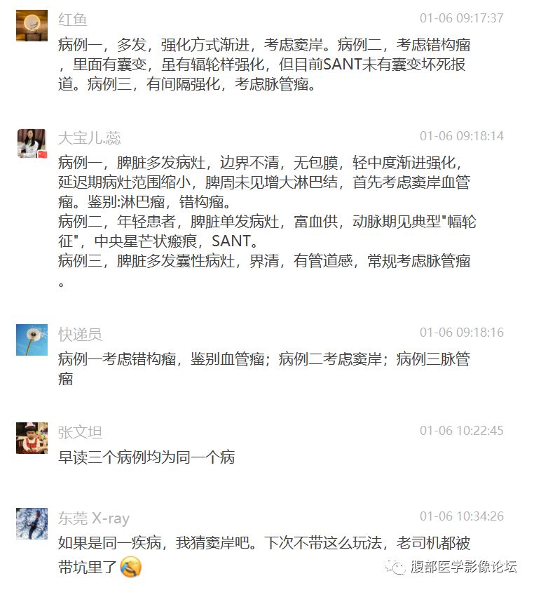 【病例】脾脏窦岸细胞血管瘤三例讨论及文献复习