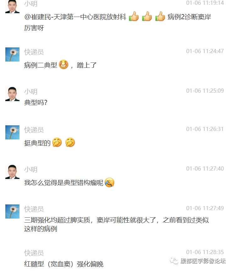 【病例】脾脏窦岸细胞血管瘤三例讨论及文献复习