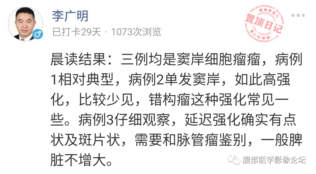 【病例】脾脏窦岸细胞血管瘤三例讨论及文献复习