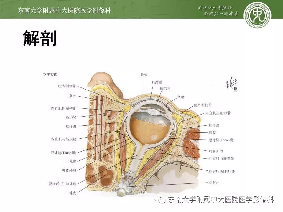 【PPT】Graves眼病