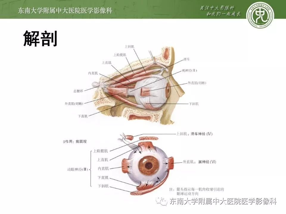 【PPT】Graves眼病