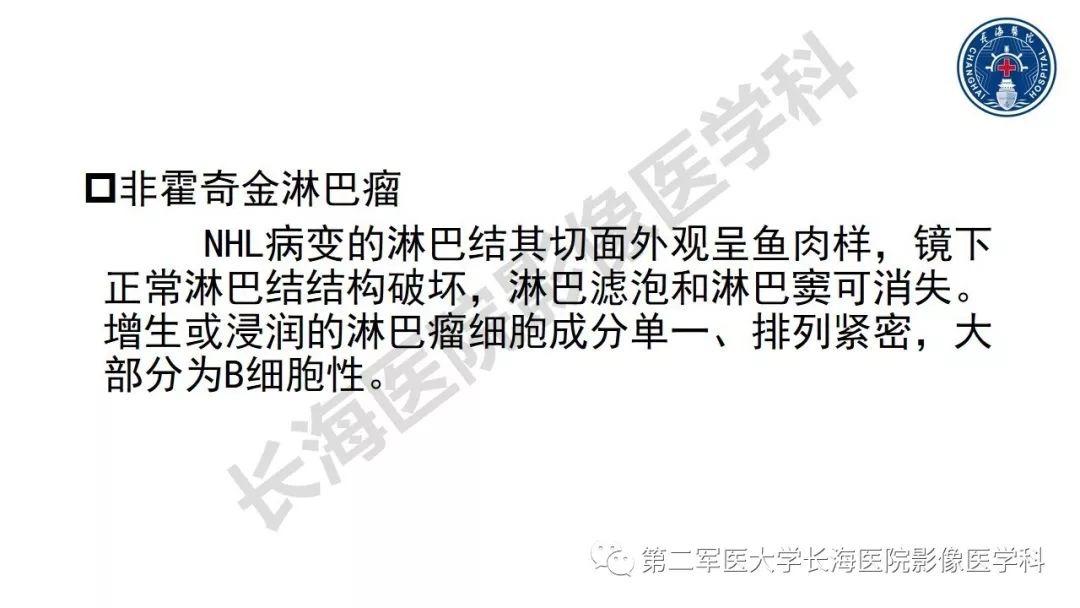 【PPT】胰腺淋巴瘤