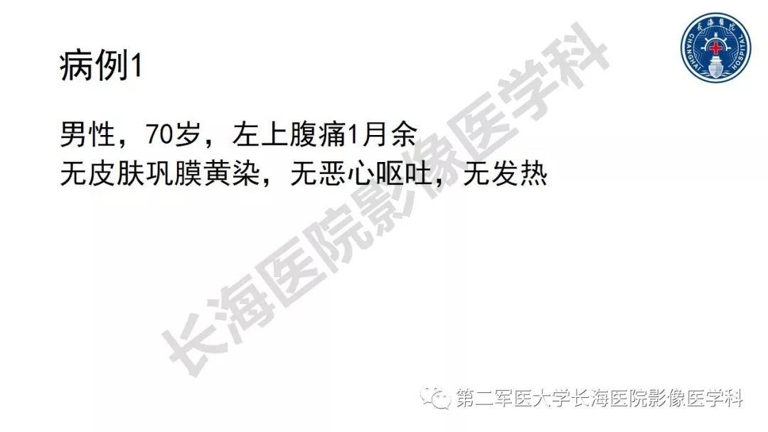 【PPT】胰腺淋巴瘤