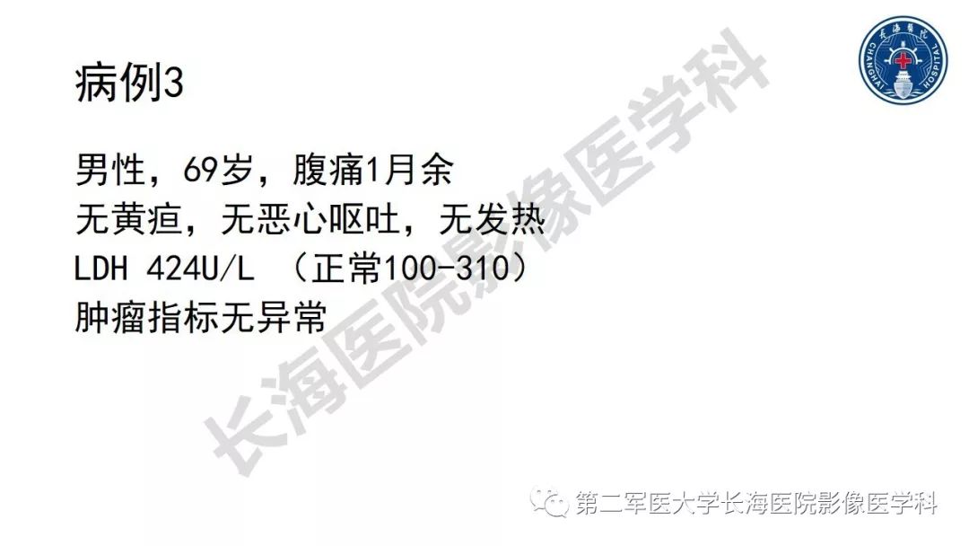 【PPT】胰腺淋巴瘤