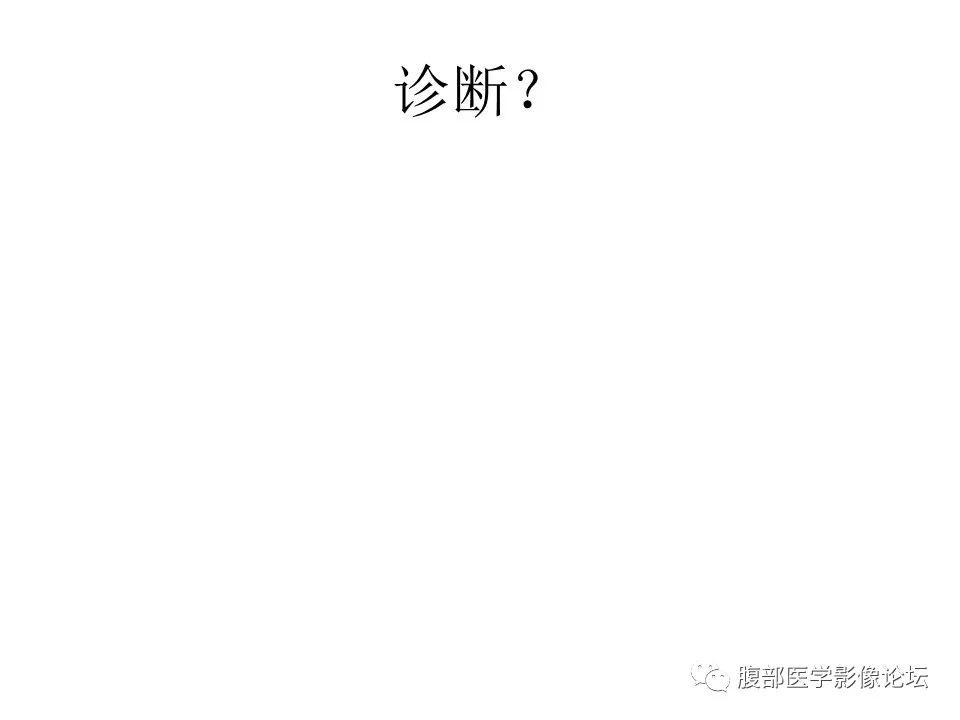 【病例】胃肠道间质瘤1例CT影像