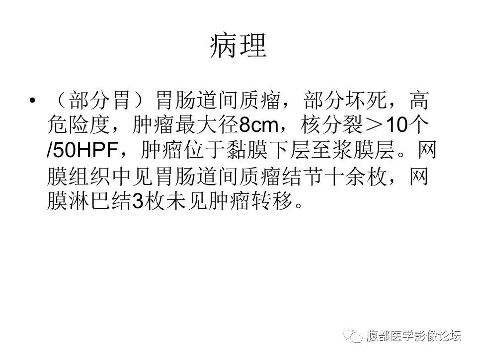 【病例】胃肠道间质瘤1例CT影像