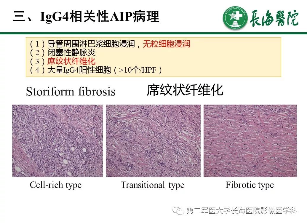 【PPT】IgG4相关性自身免疫性胰腺炎及相关性疾病