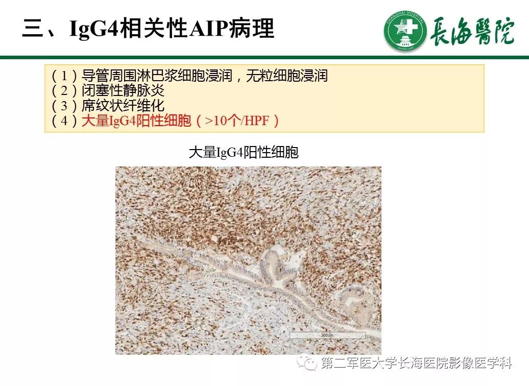 【PPT】IgG4相关性自身免疫性胰腺炎及相关性疾病