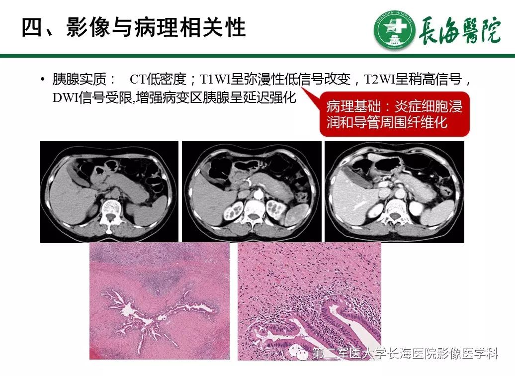 【PPT】IgG4相关性自身免疫性胰腺炎及相关性疾病