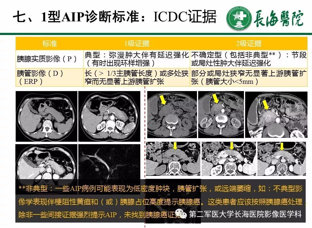 【PPT】IgG4相关性自身免疫性胰腺炎及相关性疾病
