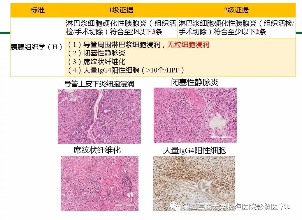 【PPT】IgG4相关性自身免疫性胰腺炎及相关性疾病