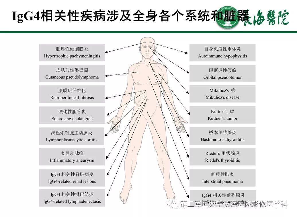 【PPT】IgG4相关性自身免疫性胰腺炎及相关性疾病