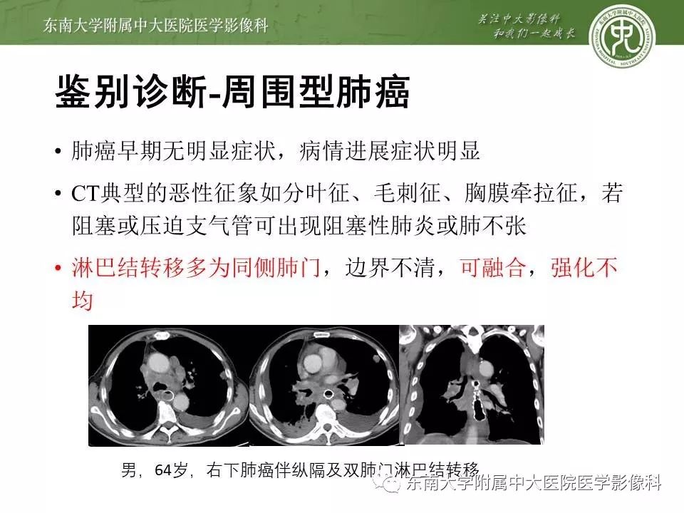 【PPT】结节病