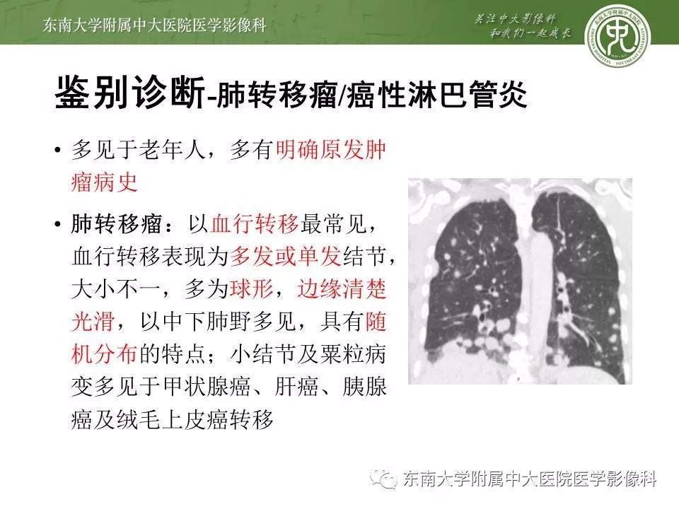 【PPT】结节病
