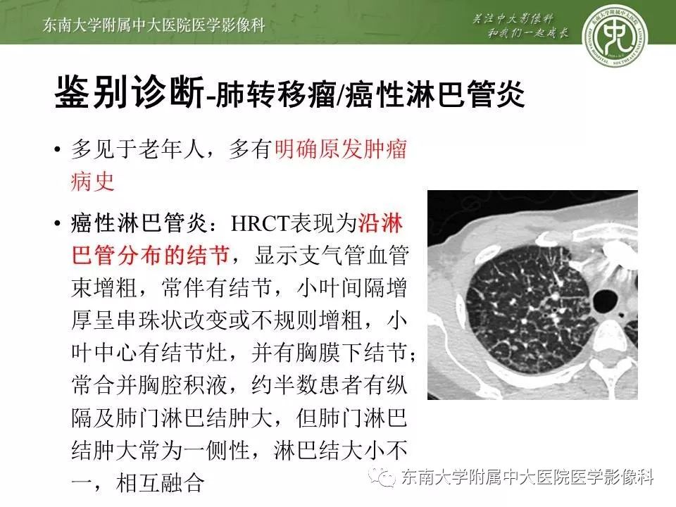 【PPT】结节病