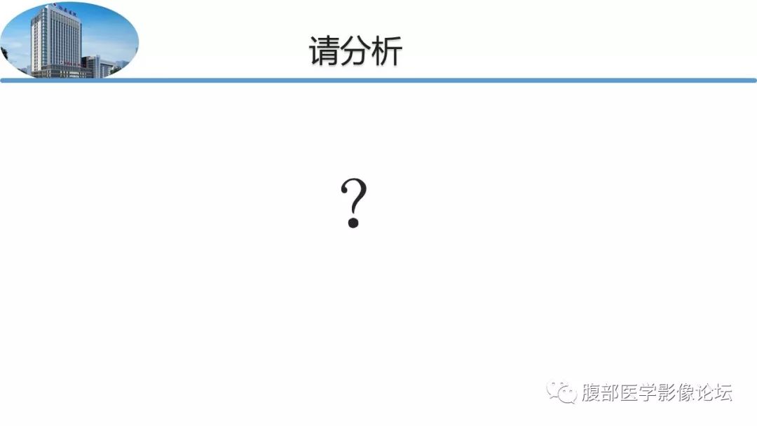 【病例】胃肠道间质瘤1例CT影像