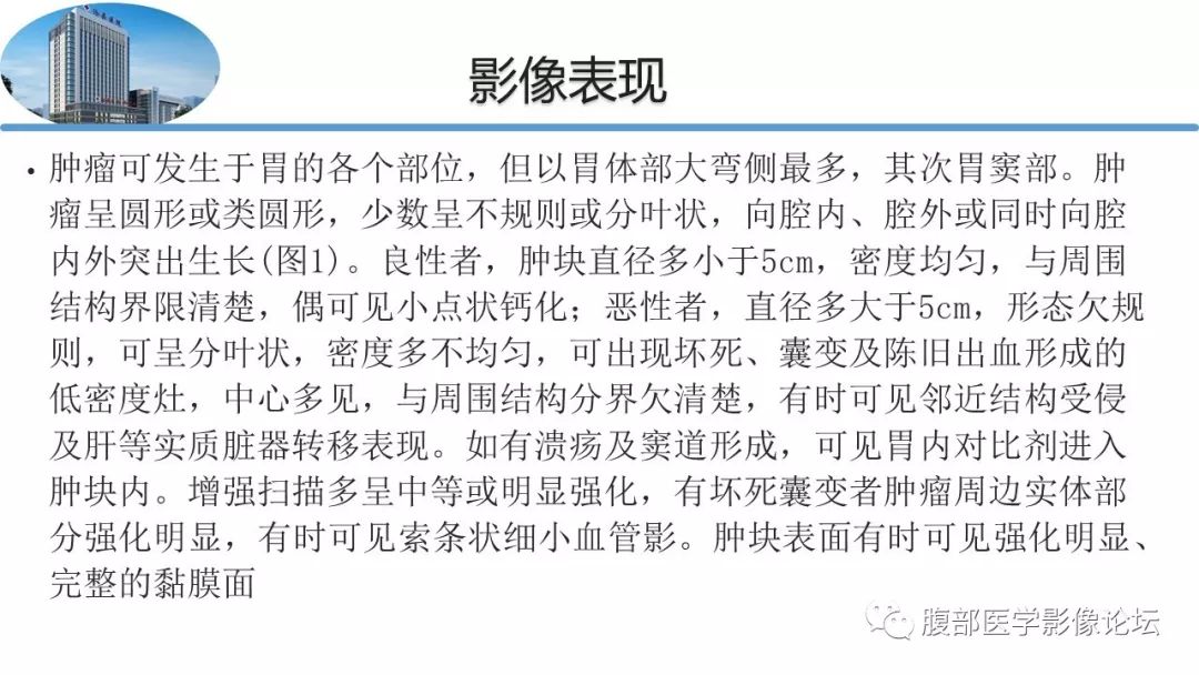 【病例】胃肠道间质瘤1例CT影像