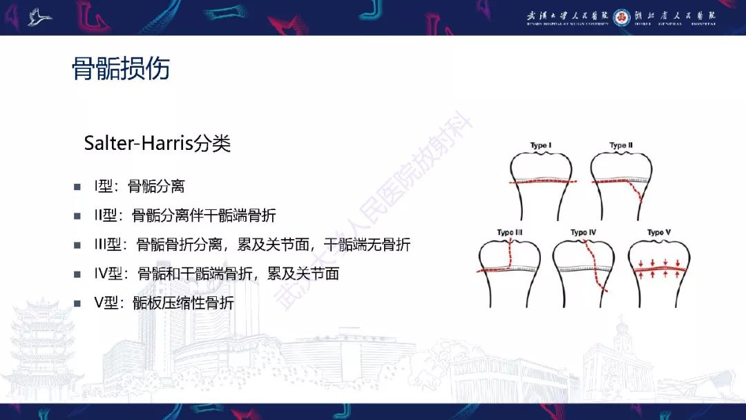 【PPT】踝关节运动损伤MR诊断