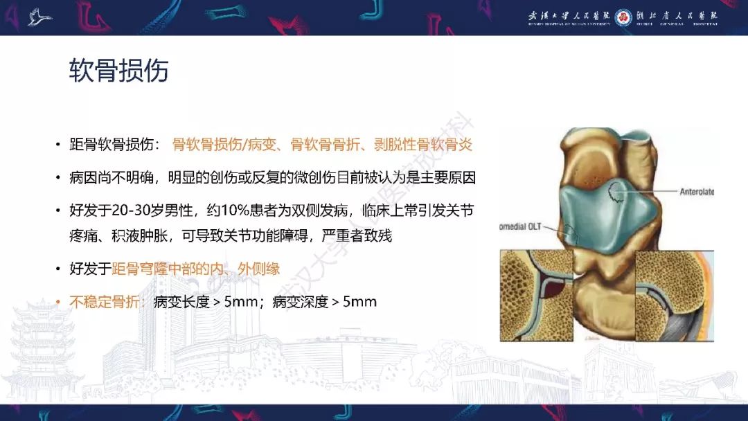 【PPT】踝关节运动损伤MR诊断