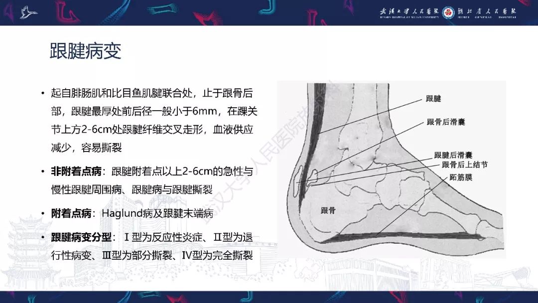 【PPT】踝关节运动损伤MR诊断