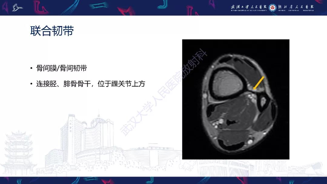 【PPT】踝关节运动损伤MR诊断