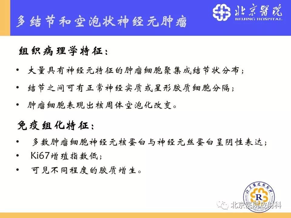 【PPT】多结节和空泡状神经元肿瘤