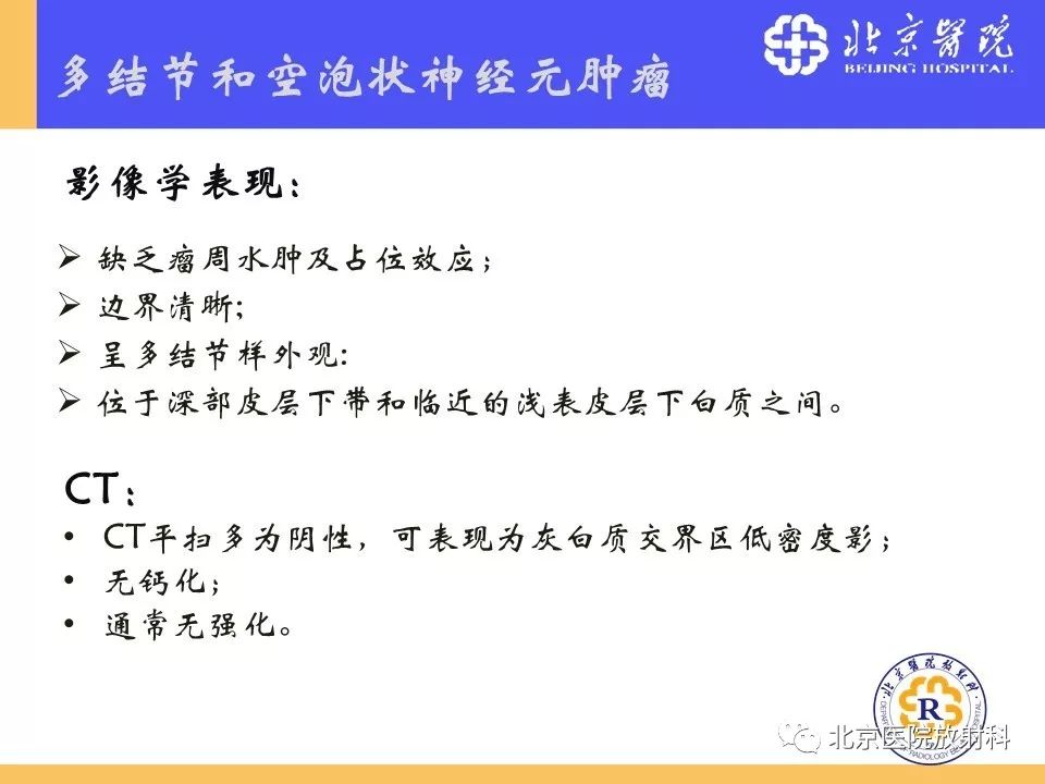 【PPT】多结节和空泡状神经元肿瘤