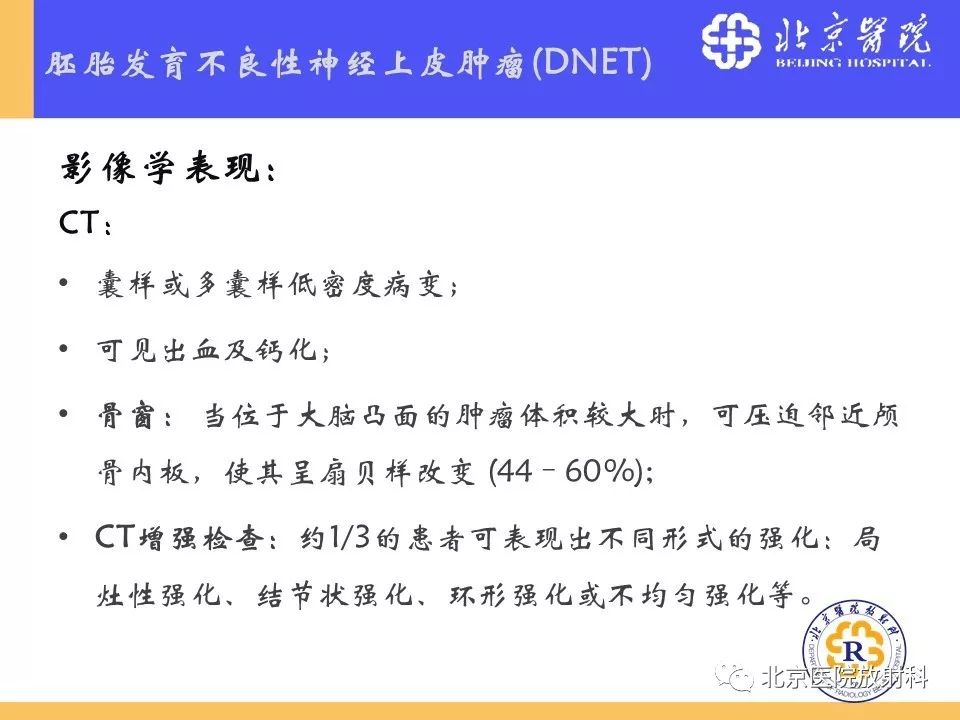 【PPT】多结节和空泡状神经元肿瘤