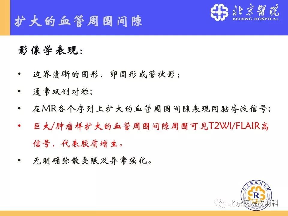 【PPT】多结节和空泡状神经元肿瘤