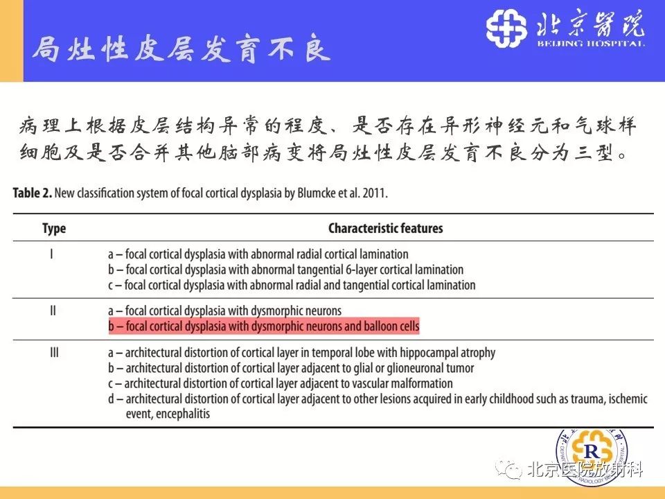 【PPT】多结节和空泡状神经元肿瘤