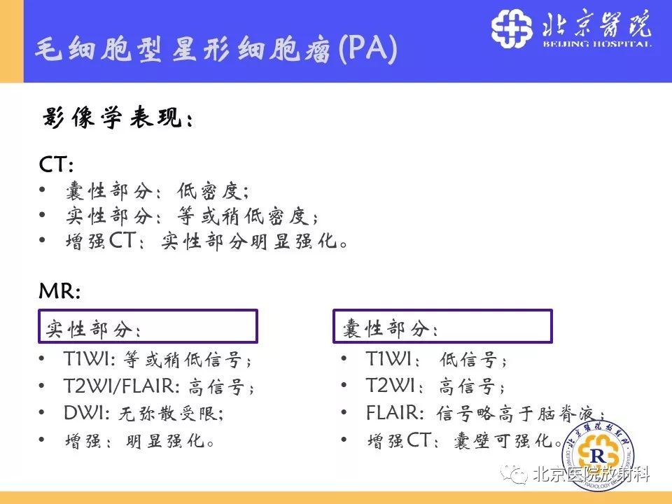 【PPT】多结节和空泡状神经元肿瘤