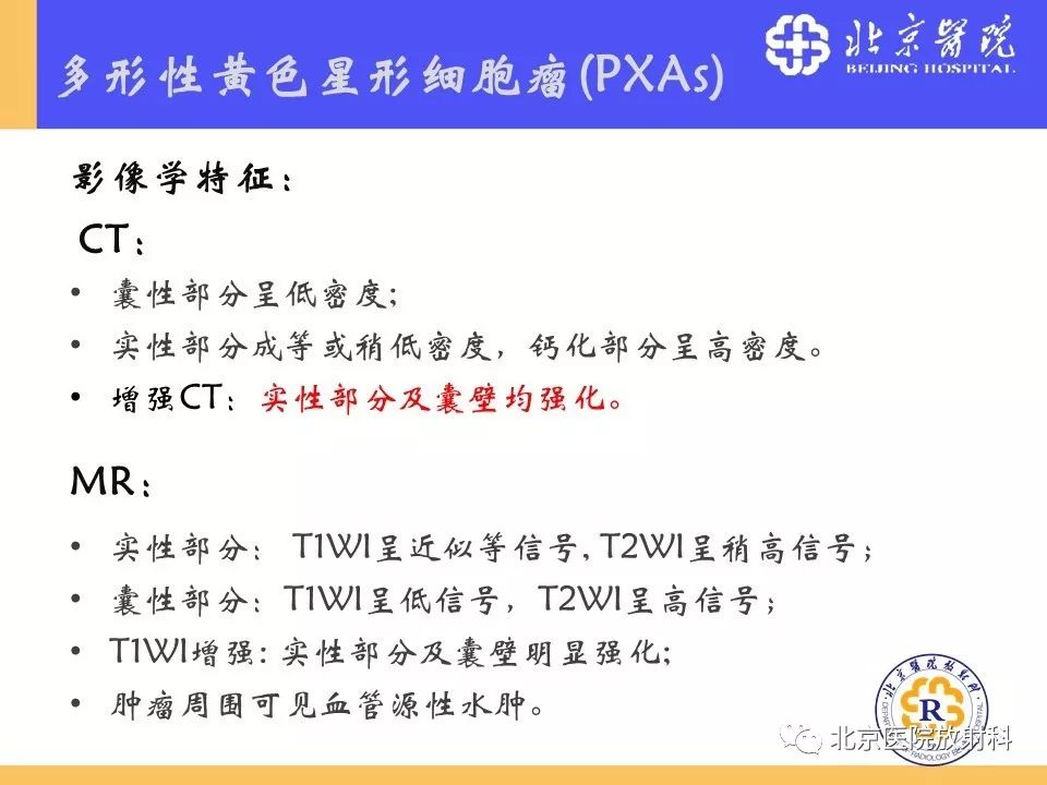 【PPT】多结节和空泡状神经元肿瘤
