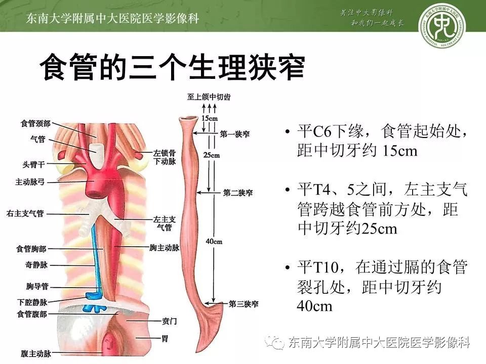 【PPT】食管癌并发食管瘘及其影像学表现