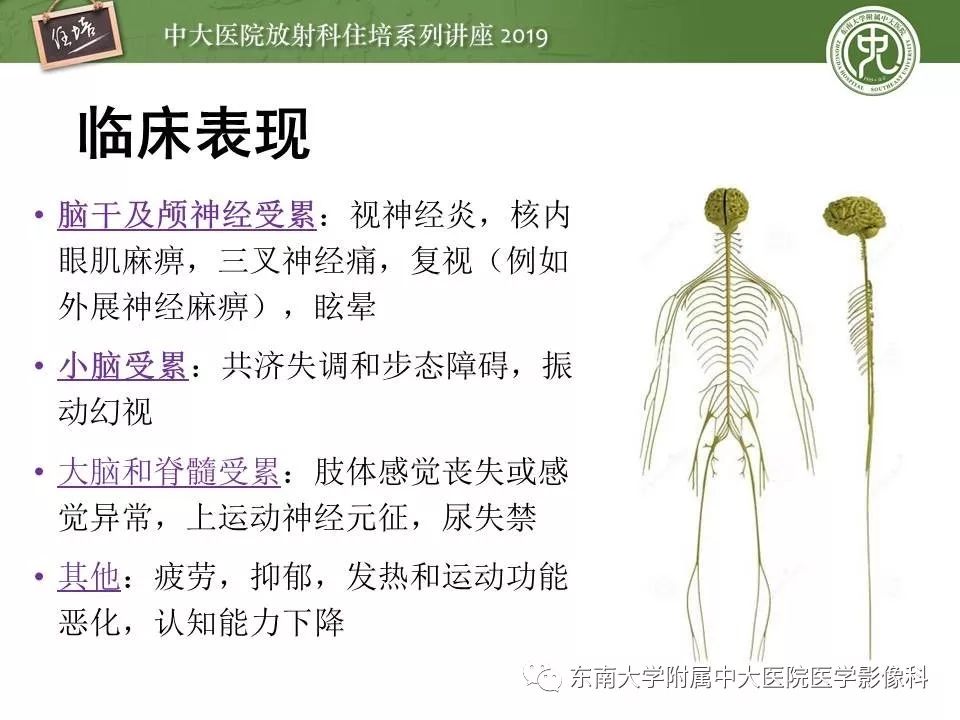 【PPT】多发性硬化的影像表现及鉴别诊断