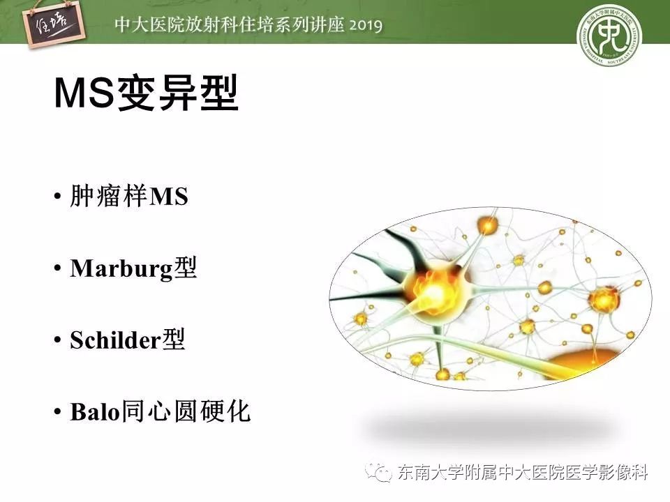 【PPT】多发性硬化的影像表现及鉴别诊断