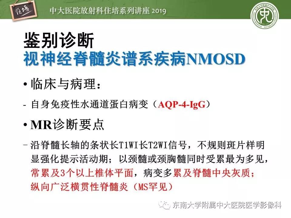 【PPT】多发性硬化的影像表现及鉴别诊断