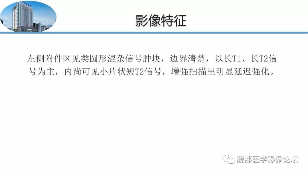【病例】卵巢硬化性间质瘤1例MR影像诊断
