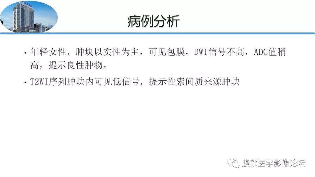 【病例】卵巢硬化性间质瘤1例MR影像诊断